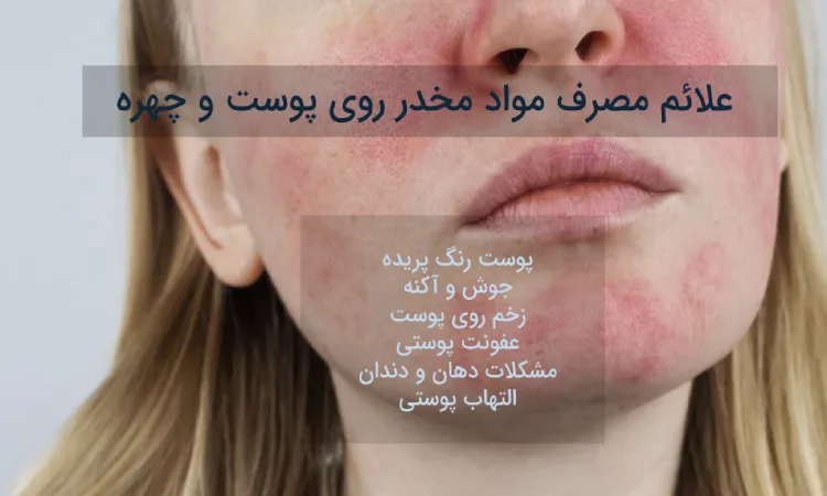 تاثیرات مصرف مواد مخدر روی پوست و چهره